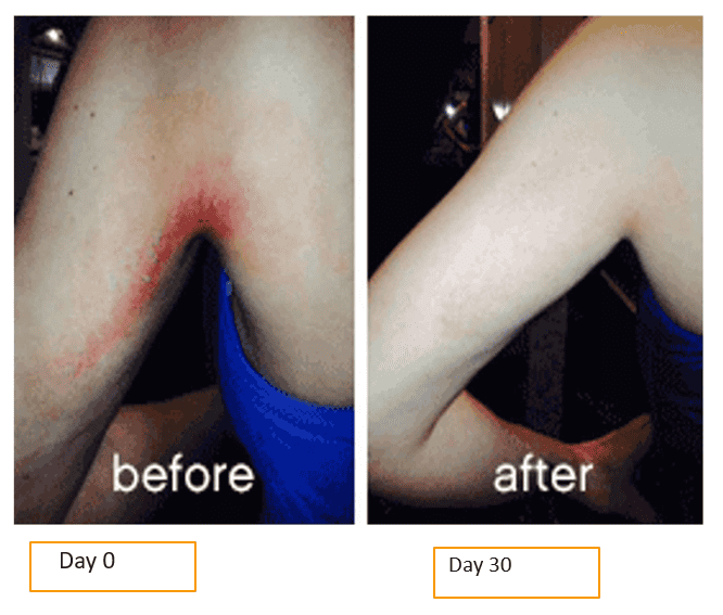 Before & After Treatment images in Carrollton, TX