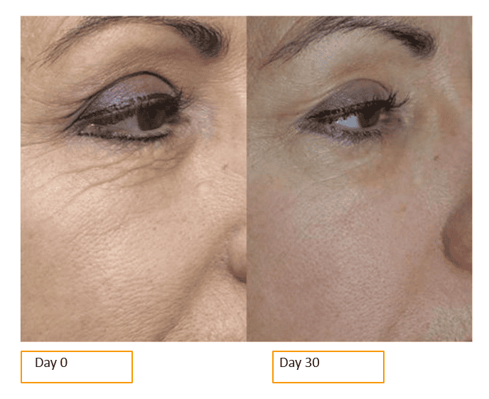 Before & After Treatment images | NWME Aesthetics | Carrollton, TX