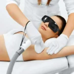 Laser Hair Removal by NWME Aesthetics in Carrollton, TX