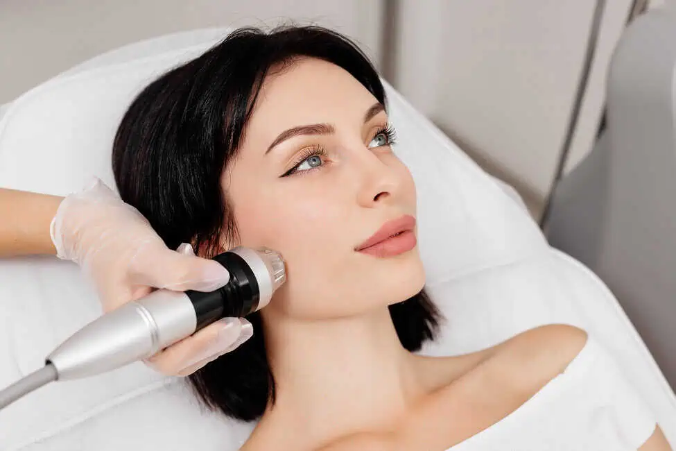 RF Microneedling by NWME Aesthetics in Carrollton TX 1