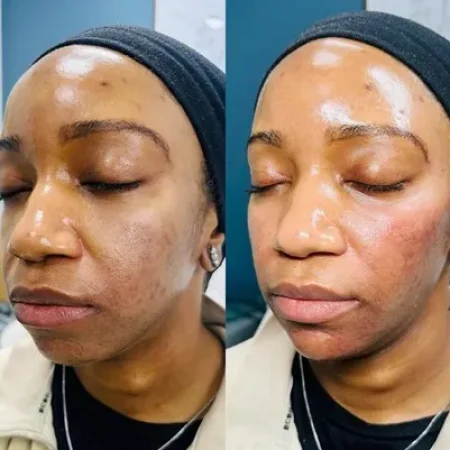 NWMEFacialBalancingB&A-f-a-nwme-aesthetics