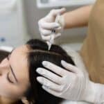 How Do Natural Growth Factor Injections Benefit the Hair